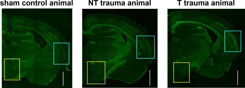 Tinnitus is associated with increased extracellular matrix density in the auditory cortex of Mongolian gerbils.