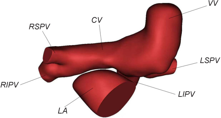 Numerical modeling assisting in surgical treatment of total anomalous pulmonary venous connection in children.