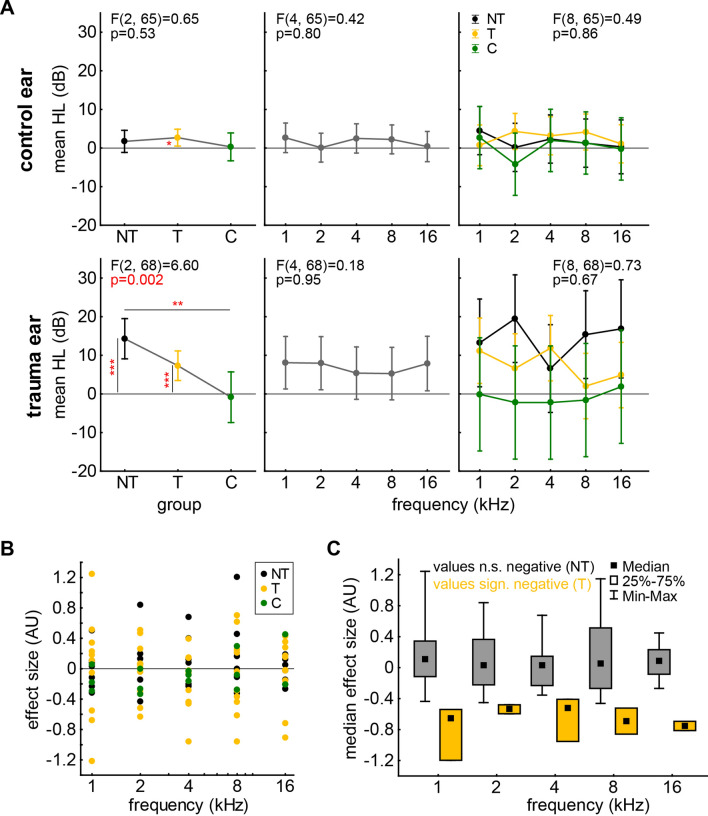 Tinnitus is associated with increased extracellular matrix density in the auditory cortex of Mongolian gerbils.