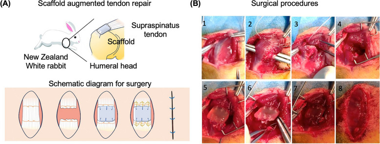Establishing a rabbit model with massive supraspinatus tendon defect for investigating scaffold-assisted tendon repair.