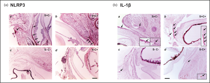 Impact of inflammasomes on the ocular surface.