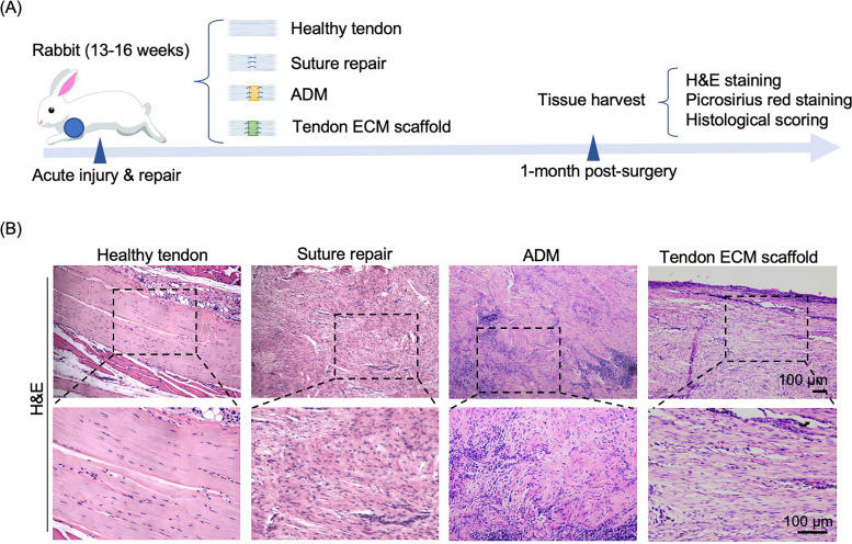 Establishing a rabbit model with massive supraspinatus tendon defect for investigating scaffold-assisted tendon repair.
