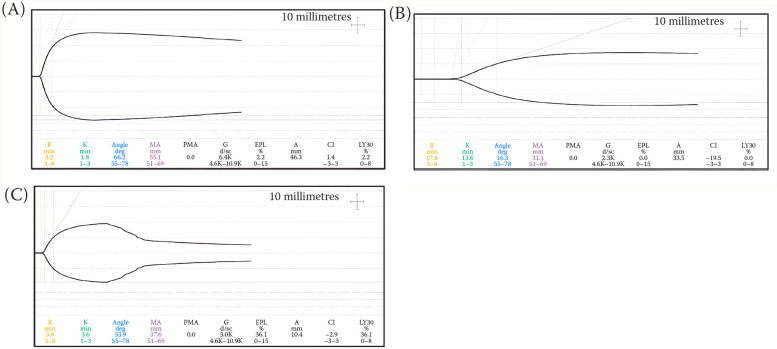 Evaluation of coagulation by thromboelastography and a velocity curve in dogs with parvoviral enteritis.