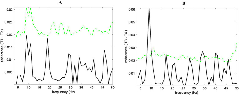 Revisiting the earliest hyperscanning study: power and functional connectivity in the alpha band may link brains far apart.