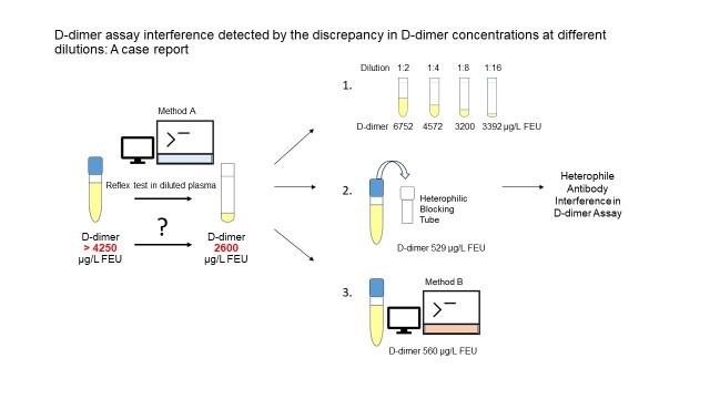D-dimer assay interference detected by the discrepancy in D-dimer concentrations at different dilutions: a case report.