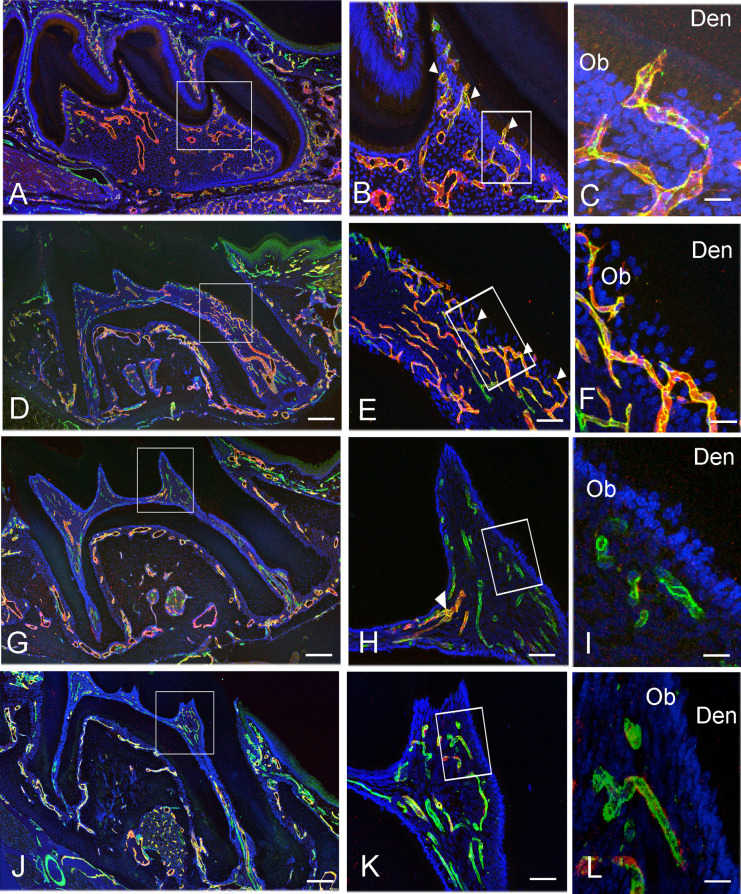 Localization of Both CD31- and Endomucin-Expressing Vessels in Mouse Dental Pulp.