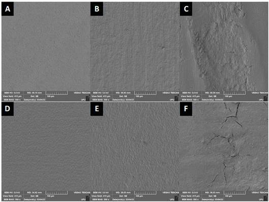 Effect of Periodontal Instrumentation on Tooth Structure Exposure to Ionizing Radiation: In Vitro Study.