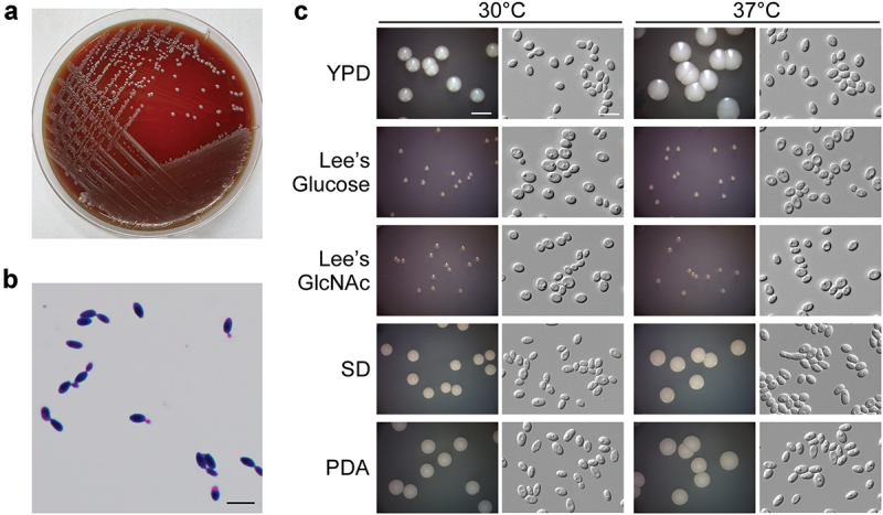 First case of fungemia caused by a rare and pan-echinocandin resistant yeast <i>Sporopachydermia lactativora</i> in China.