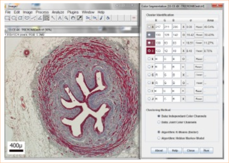 Segmental histomorphometry of the porcine ureter for use as a vascular xenograft.