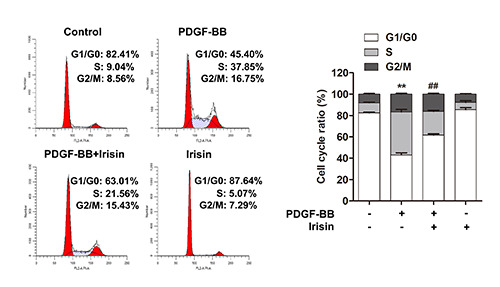 Irisin suppresses PDGF-BB-induced proliferation of vascular smooth muscle cells <i>in vitro</i> by activating AMPK/mTOR-mediated autophagy.