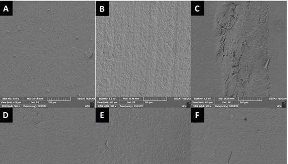 Effect of Periodontal Instrumentation on Tooth Structure Exposure to Ionizing Radiation: In Vitro Study.