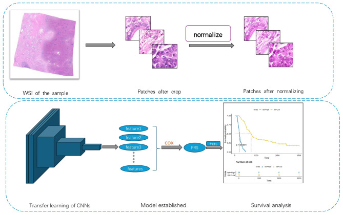 Construction of a combined prognostic model for pancreatic ductal adenocarcinoma based on deep learning and digital pathology images.