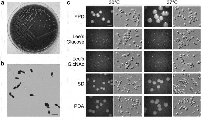 First case of fungemia caused by a rare and pan-echinocandin resistant yeast <i>Sporopachydermia lactativora</i> in China.