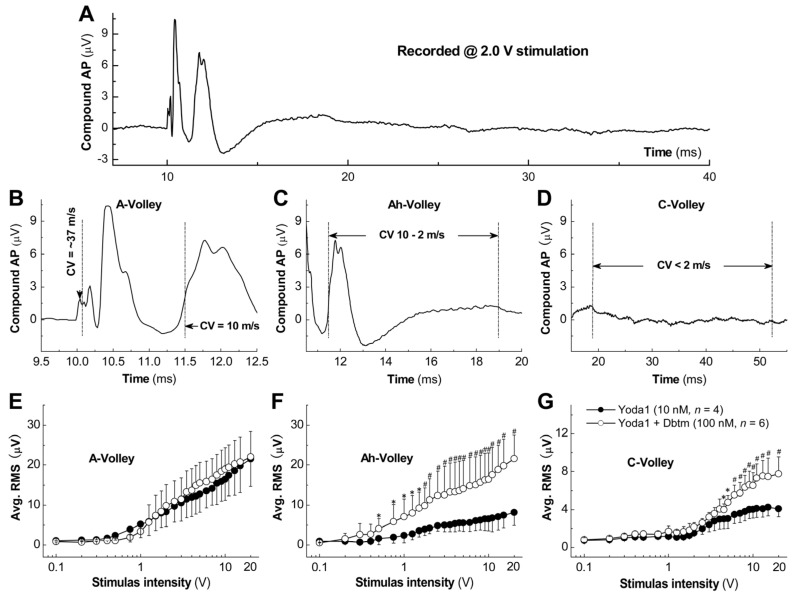 Caution for Multidrug Therapy: Significant Baroreflex Afferent Neuroexcitation Coordinated by Multi-Channels/Pumps Under the Threshold Concentration of Yoda1 and Dobutamine Combination.