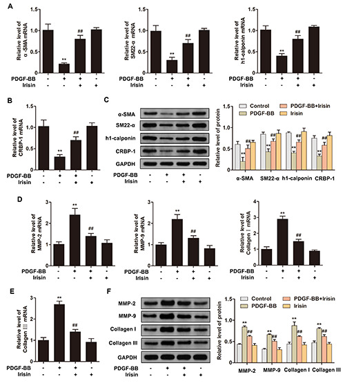 Irisin suppresses PDGF-BB-induced proliferation of vascular smooth muscle cells <i>in vitro</i> by activating AMPK/mTOR-mediated autophagy.