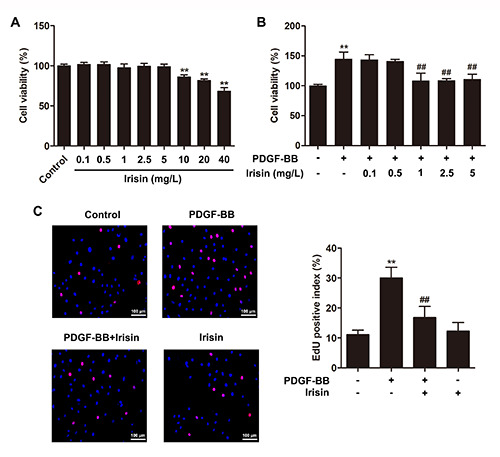 Irisin suppresses PDGF-BB-induced proliferation of vascular smooth muscle cells <i>in vitro</i> by activating AMPK/mTOR-mediated autophagy.