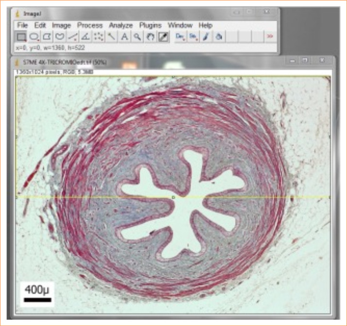 Segmental histomorphometry of the porcine ureter for use as a vascular xenograft.