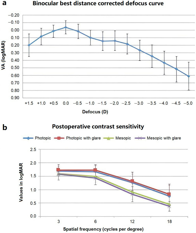 Visual and patient reported outcomes provided by a refractive multifocal intraocular lens based on continuous transitional focus.