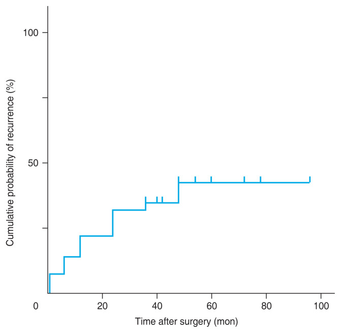 Long-term Outcomes of Bilateral Lateral Rectus Recession Using a Modified Normogram for Targeting Small Overcorrection in Intermittent Exotropia.