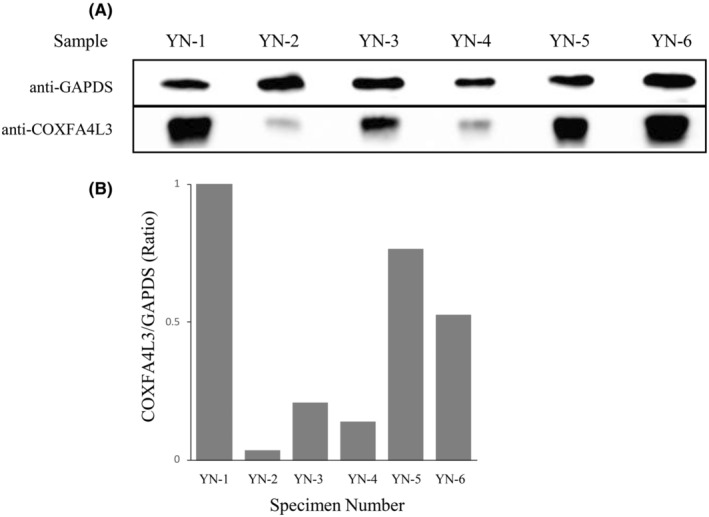 Ectopic expression of the mitochondrial protein COXFA4L3 in human sperm acrosome and its potential application in the selection of male infertility treatments.