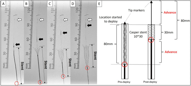 Important Notes for Preventing Entrapment of Distal Filter-based Embolic Protection Device in Carotid Artery Stenting.