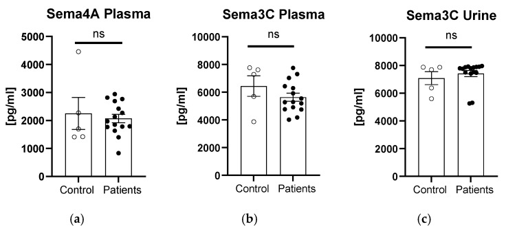 A Pilot Study of the Role of Semaphorin 4A (sema4A) and 3C (sema3C) in Non-Muscle-Invasive Bladder Cancer (NMIBC).