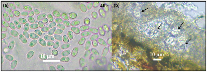 Prevalence of bean scab caused by <i>Elsinoë phaseoli</i> and challenges associated with bean cultivation in Kenya.