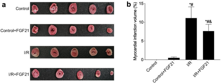 Fibroblast Growth Factor 21 Suppressed Neutrophil Extracellular Traps Induced by Myocardial Ischemia/Reperfusion Injury via Adenosine Monophosphate-Activated Protein Kinase.