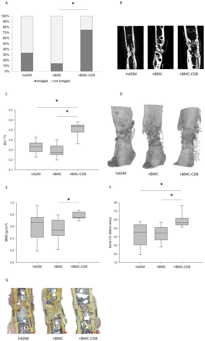 Enhancement of a one-step membrane technique for the treatment of large bone defects by pre-seeding the membrane with CD8 lymphocyte depleted bone marrow mononuclear cells in a rat femoral defect model.