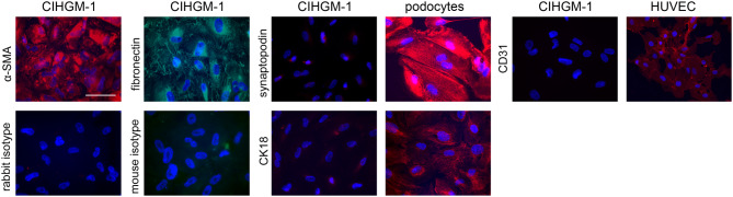 Replication kinetics of pathogenic Eurasian orthohantaviruses in human mesangial cells.