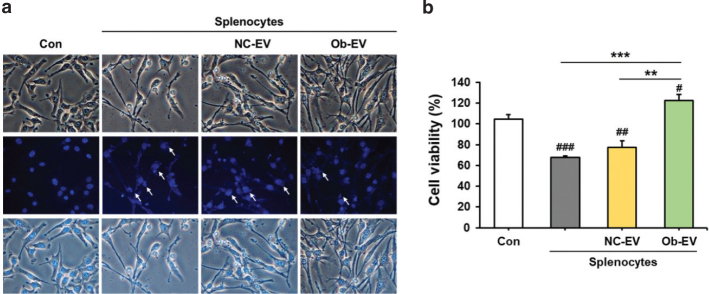 Adipose tissue-derived extracellular vesicles from obese mice suppressed splenocyte-mediated pancreatic cancer cell death.