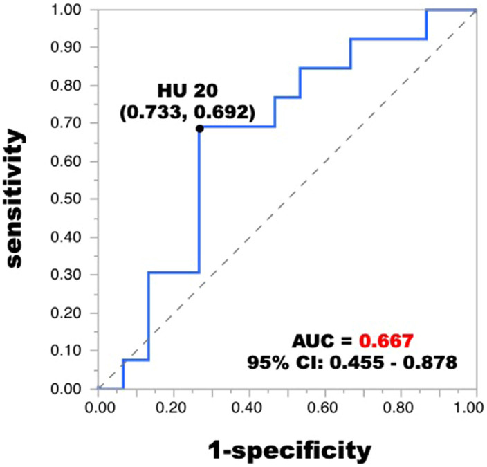 Hounsfield Unit on Preoperative Computed Tomography as an Indicator of Prognosis in Patients with Liposarcoma.