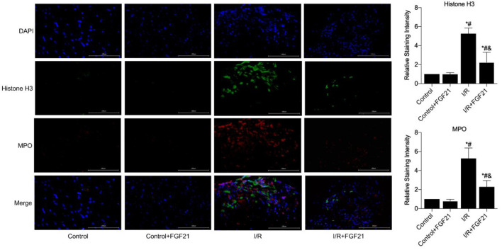 Fibroblast Growth Factor 21 Suppressed Neutrophil Extracellular Traps Induced by Myocardial Ischemia/Reperfusion Injury via Adenosine Monophosphate-Activated Protein Kinase.