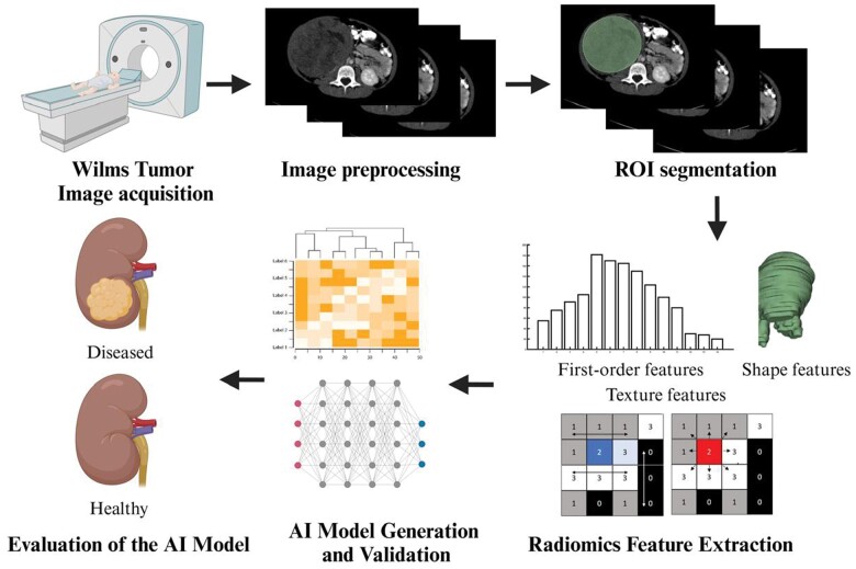 A review on optimization of Wilms tumour management using radiomics.
