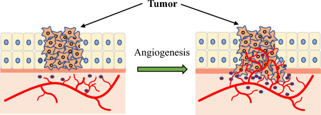 Beyond starving cancer: anti-angiogenic therapy.