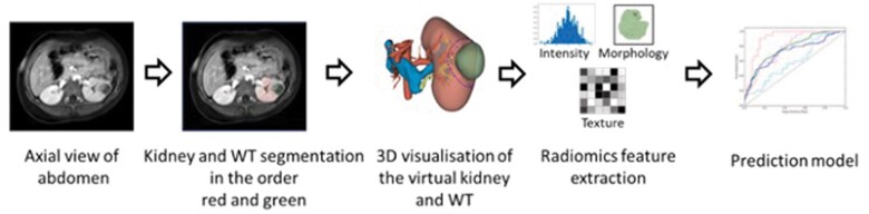 A review on optimization of Wilms tumour management using radiomics.
