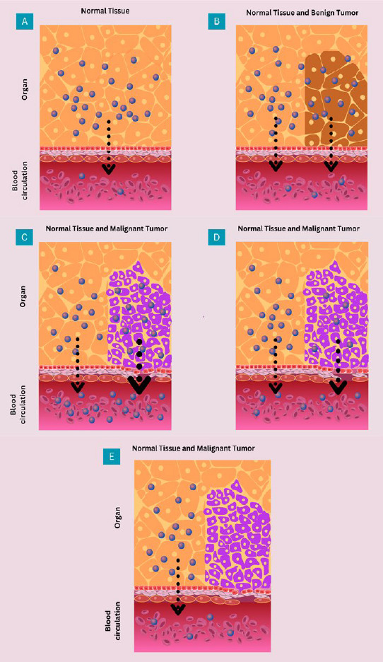Cancer Biomarker Concentration Changes During Tumor Progression.