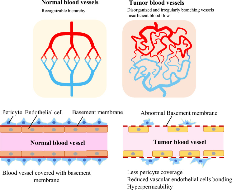 Beyond starving cancer: anti-angiogenic therapy.