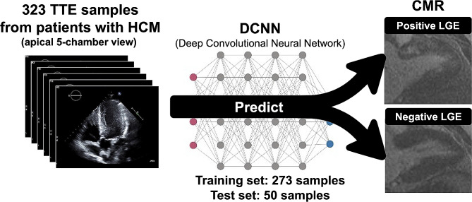 Deep learning of echocardiography distinguishes between presence and absence of late gadolinium enhancement on cardiac magnetic resonance in patients with hypertrophic cardiomyopathy.