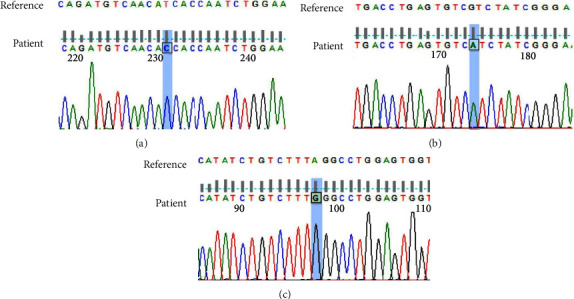 Case of T-B+NK+ X-Linked Severe Combined Immunodeficiency Disease.