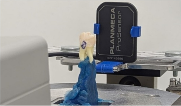 Enhancement of early proximal caries annotations in radiographs: introducing the Diagnostic Insights for Radiographic Early-caries with micro-CT (ACTA-DIRECT) dataset.