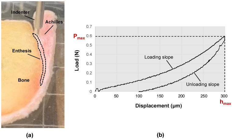The Correlation between the Elastic Modulus of the Achilles Tendon Enthesis and Bone Microstructure in the Calcaneal Crescent.