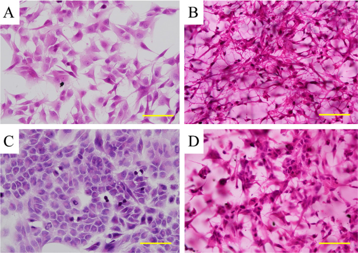 Three-Dimensional Culture of Glioblastoma Cells Using a Tissueoid Cell Culture System.