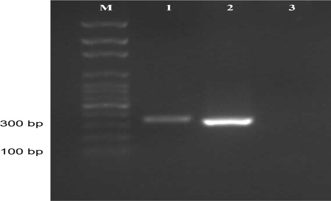 Molecular Tracking of <i>Leishmania major</i> in an Archived <i>Rattus norvegicus</i> Spleen Sample in Iran: A Case Report.