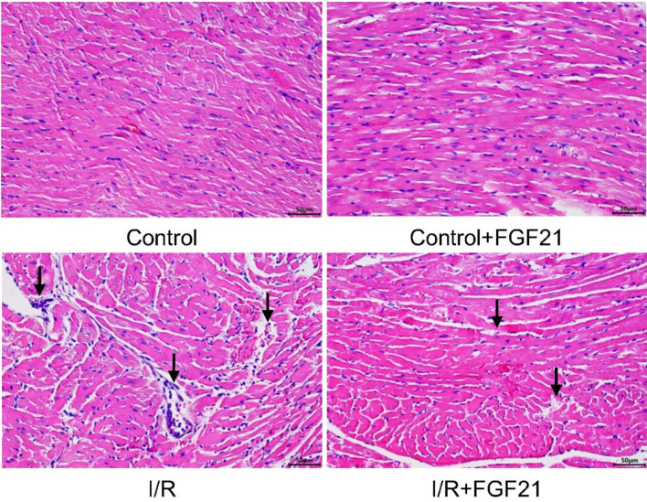 Fibroblast Growth Factor 21 Suppressed Neutrophil Extracellular Traps Induced by Myocardial Ischemia/Reperfusion Injury via Adenosine Monophosphate-Activated Protein Kinase.