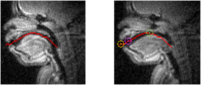 Vertical larynx actions and intergestural timing stability in Hausa ejectives and implosives.