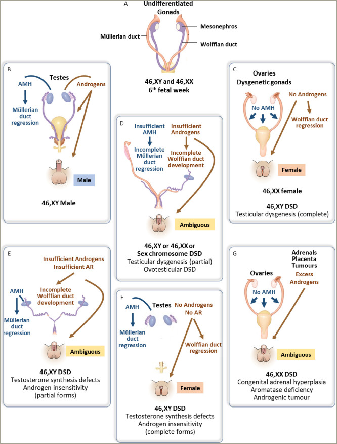 The Approach to Patients with Disorders of Sex Development (DSD) in the Era of Precision Medicine: The Careful Use of Terminology.