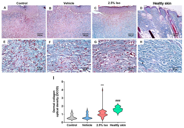 Isoorientin Improves Excisional Skin Wound Healing in Mice.