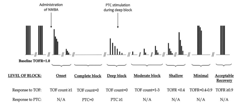 Neuromuscular blockade monitoring in pediatric patients.