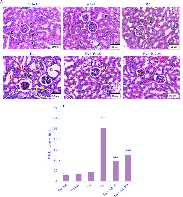 SIRT1/NOX1 pathway mediated ameliorative effects of rosmarinic acid in folic acid-induced renal injury.